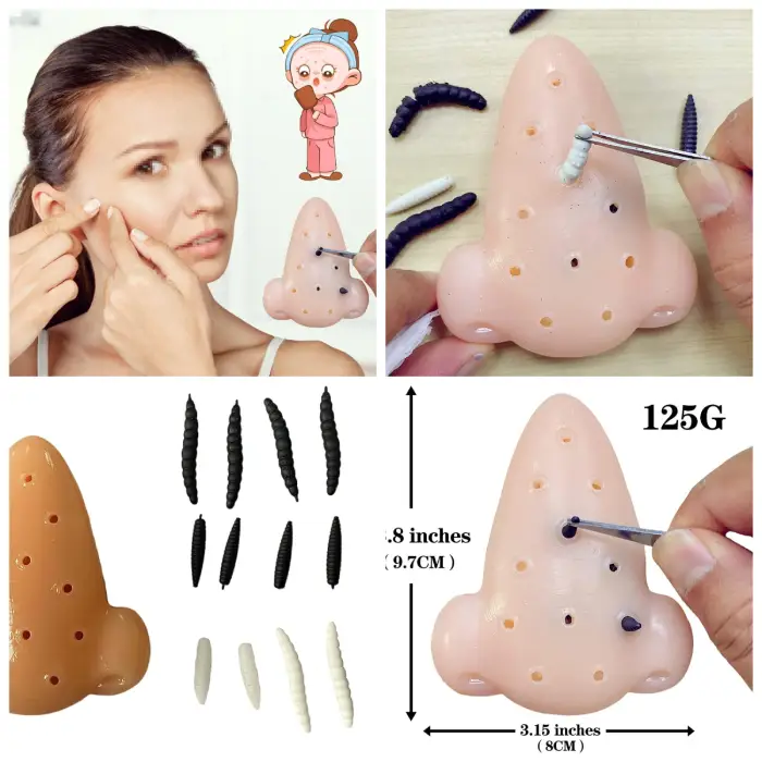 Pimple Popper Toy,spot Popper Pimple Popping Toy